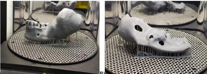 A) Example of Good orientation versus B) Example of bad orientation